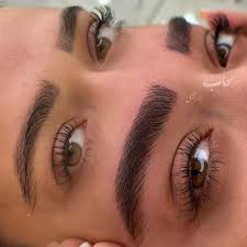 نمونه فیبروز سحاب ابراهیمی